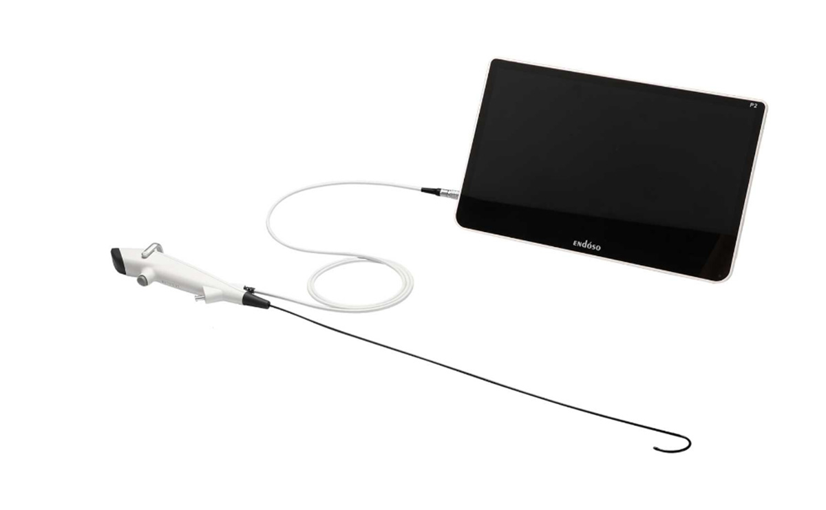 一次性電子內(nèi)窺鏡設(shè)計(jì)-3.jpg 一次性電子內(nèi)窺鏡設(shè)計(jì)-3.jpg